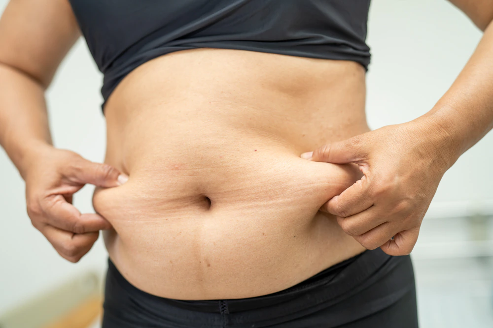 Belly fat